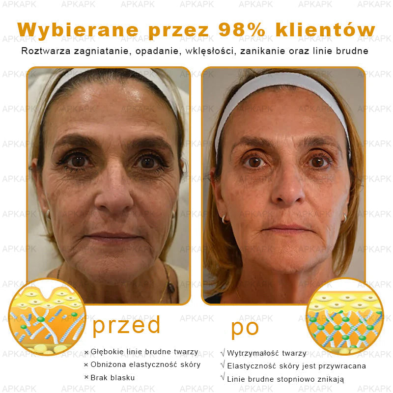 ⏰ Zostało tylko kilka sztuk na magazynie! Skorzystaj z wyjątkowej zniżki -30%⏰ΑPΚΑPK™