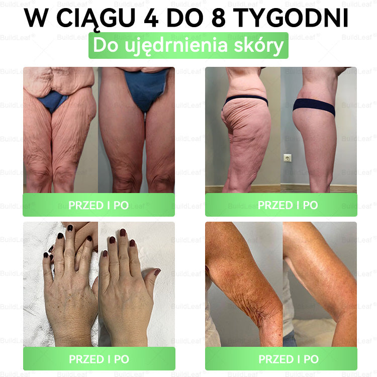 ♻️𝖮𝖋𝗶𝗰𝗷𝗮𝗹𝗻𝘆 𝘀𝗸𝗹𝗲𝗽 | 👩‍⚕️𝘽𝙪𝙞𝙡𝙙𝙇𝙚𝙖𝙛® 𝗚𝗟𝗣-𝟭 𝟖-w-𝟭 𝗦𝗹𝗶𝗺 & 𝑯𝒆𝒂𝒍𝒕𝐡𝐲 𝑶𝒓𝒂𝒍 𝑺𝒐𝒍𝒖𝒕𝒊𝒐𝒏 (𝑟𝑎𝑧 𝑑𝑧𝑖𝑒𝑛𝑛𝑖𝑒, 𝑟𝑒𝑧𝑢𝑙𝑡𝑎𝑡𝑦 𝑤 7 𝑑𝑛𝑖),Wspiera odchudzanie, serce, cukrzycę, sen, jelita, stawy, a także ujędrnia skórę i dodaje energii