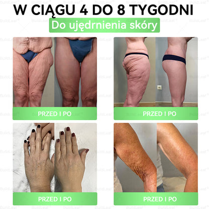 ♻️𝖮𝖋𝗶𝗰𝗷𝗮𝗹𝗻𝘆 𝘀𝗸𝗹𝗲𝗽 | 👩‍⚕️𝘽𝙪𝙞𝙡𝙙𝙇𝙚𝙖𝙛® 𝗚𝗟𝗣-𝟭 𝟖-w-𝟭 𝗦𝗹𝗶𝗺 & 𝑯𝒆𝒂𝒍𝒕𝐡𝐲 𝑶𝒓𝒂𝒍 𝑺𝒐𝒍𝒖𝒕𝒊𝒐𝒏 (𝑟𝑎𝑧 𝑑𝑧𝑖𝑒𝑛𝑛𝑖𝑒, 𝑟𝑒𝑧𝑢𝑙𝑡𝑎𝑡𝑦 𝑤 7 𝑑𝑛𝑖),Wspiera odchudzanie, serce, cukrzycę, sen, jelita, stawy, a także ujędrnia skórę i dodaje energii