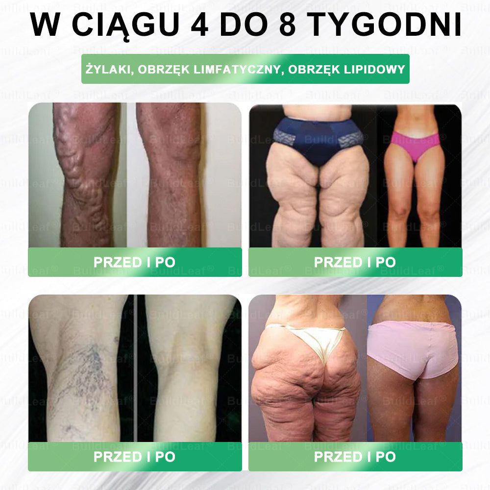 ⏰Zostało tylko kilka sztuk na magazynie! Skorzystaj z wyjątkowej zniżki -50%! Szczuplejsza sylwetka i więcej energii są w zasięgu ręki! Jeśli przegapisz tę okazję teraz, następna może pojawić się dopiero w przyszłym roku! ⏰ BuildLeaf®