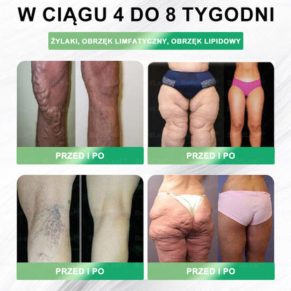 ⏰Zostało tylko kilka sztuk na magazynie! Skorzystaj z wyjątkowej zniżki -50%! Szczuplejsza sylwetka i więcej energii są w zasięgu ręki! Jeśli przegapisz tę okazję teraz, następna może pojawić się dopiero w przyszłym roku! ⏰ BuildLeaf®