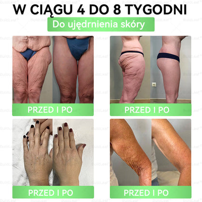 ⏰Zostało tylko kilka sztuk na magazynie! Skorzystaj z wyjątkowej zniżki -50%! Szczuplejsza sylwetka i więcej energii są w zasięgu ręki! Jeśli przegapisz tę okazję teraz, następna może pojawić się dopiero w przyszłym roku! ⏰ BuildLeaf®