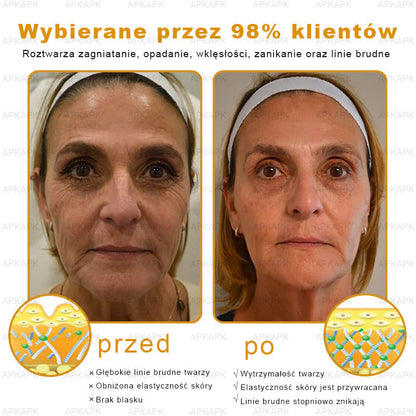 ΑPΚΑPK™ Jad Pszczoły Kompleksowy Krem🥇pomaga w leczeniu problemów skórnych, takich jak: zmarszczki, blizny, plamy pigmentacyjne, rozstępy, trądzik, łuszczyca, egzema, zmiany skórne, podrażnienia, stany zapalne i inne problemy skórne🔥